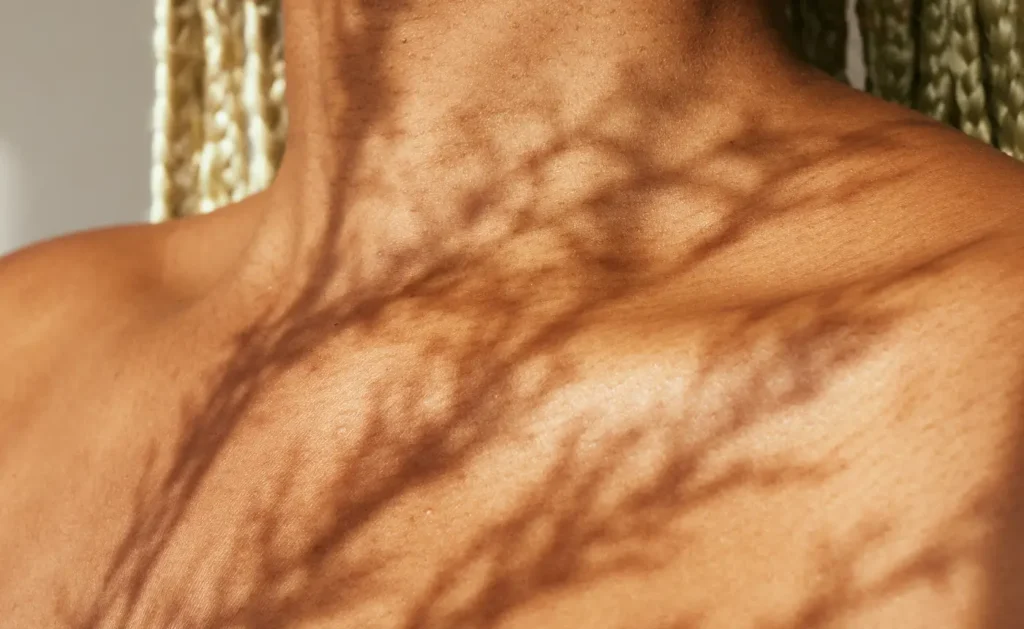 Psique do Corpo – Curso Prático de Psicoterapia Somática para Profissionais de Saúde Mental